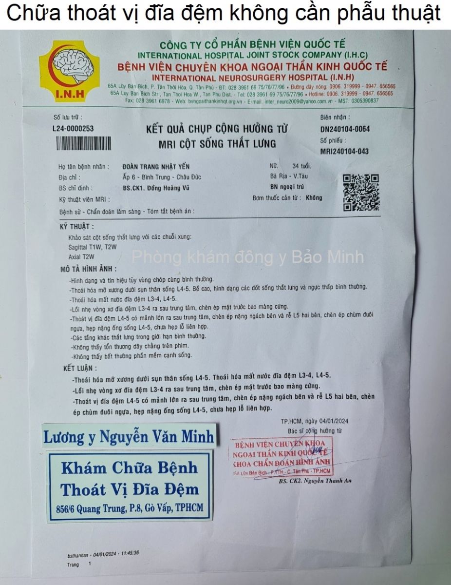 Chữa thoát vị đĩa đệm không cần phẫu thuật